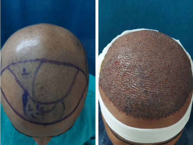 Megasessions with Optimal Results